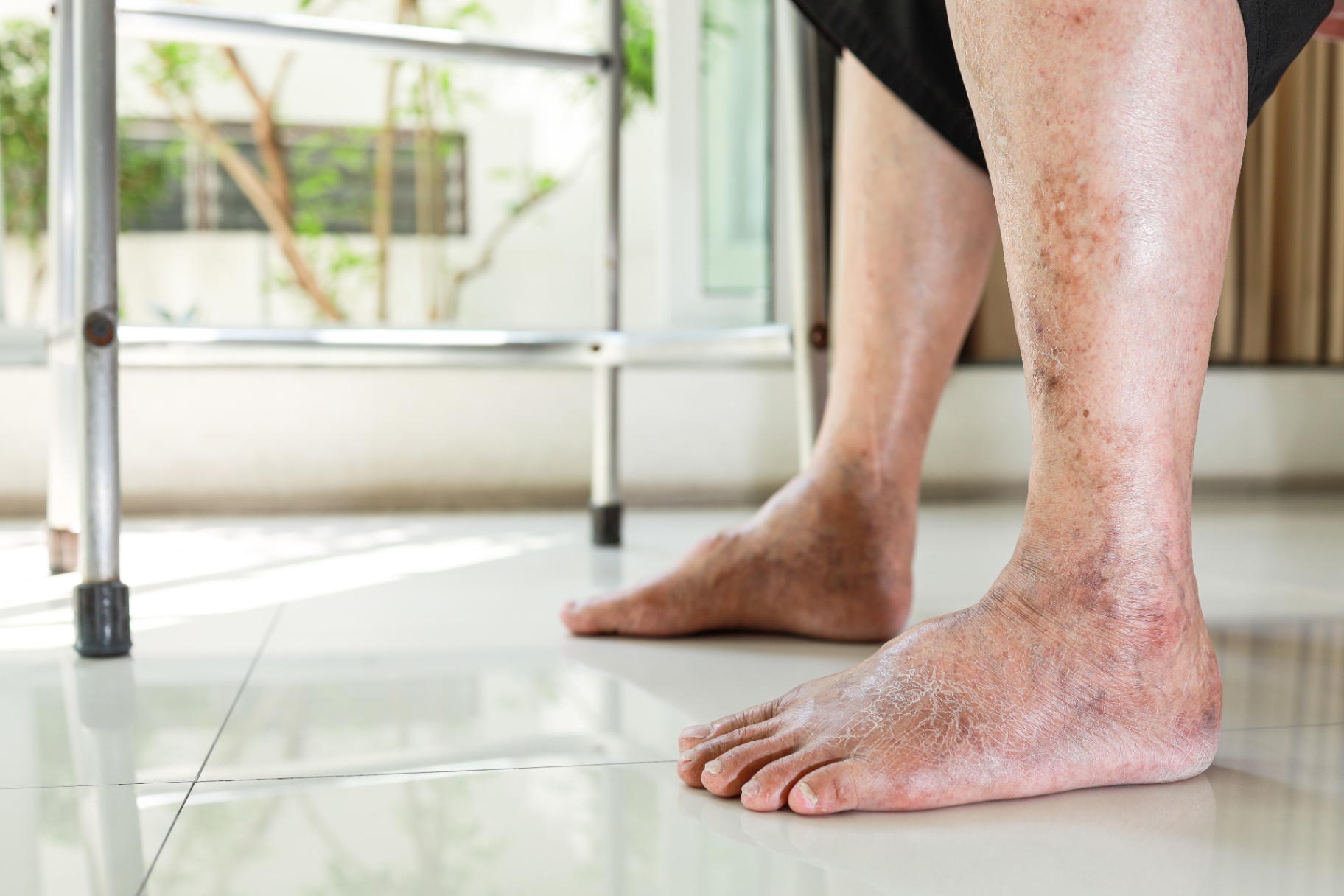 Diabetic Care